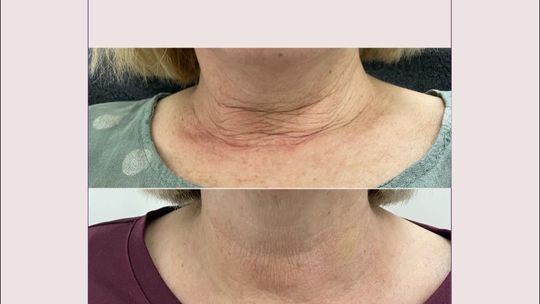 Dermatologia estetyczna we Wrocławiu